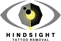 Hindsight Tattoo Removal logo