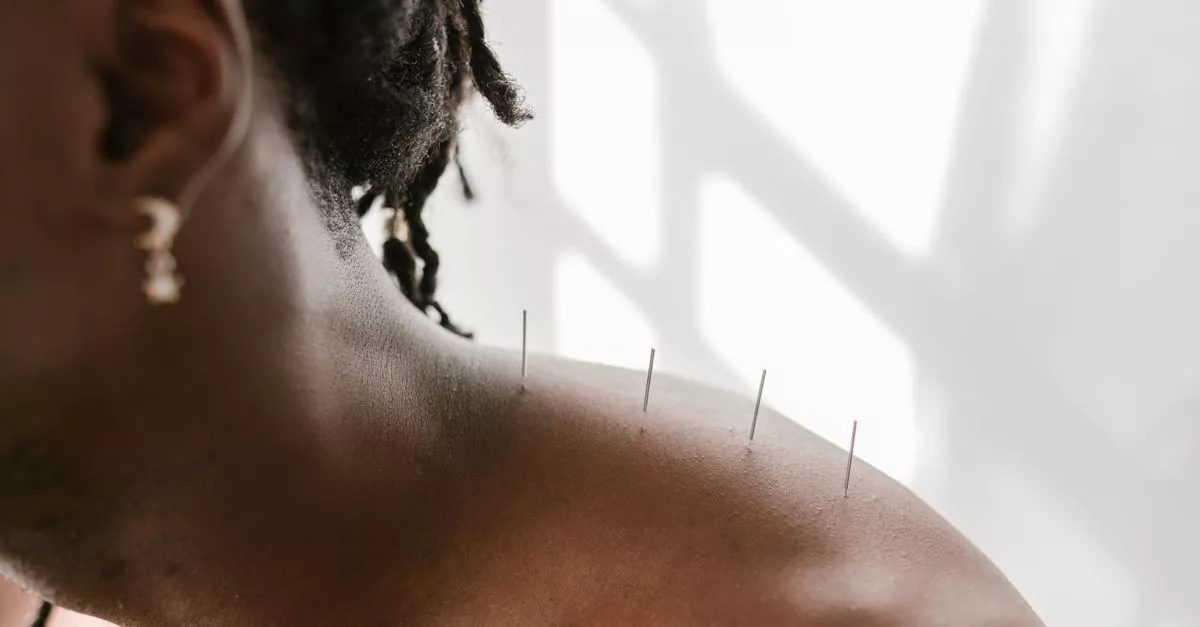 Petson Chan Acupuncture