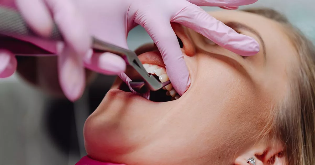 All In One Dentistry /Affordable Implants & Braces