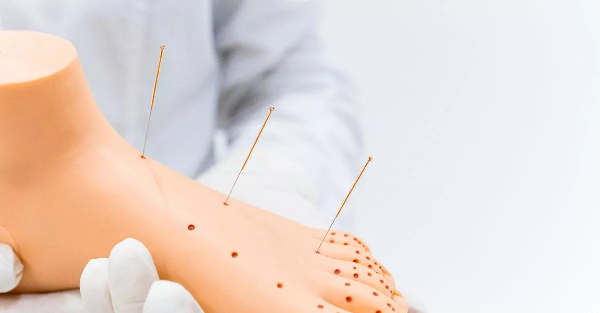 Wise Ways Acupuncture