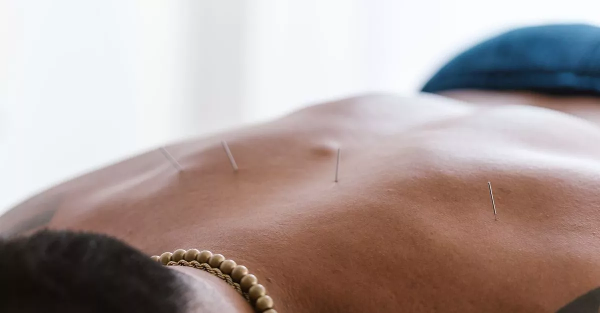 West Meets East Acupuncture