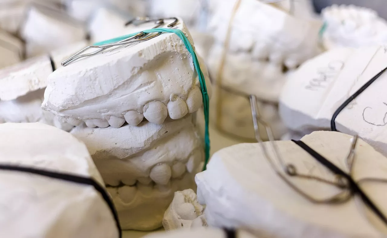 Diamond Braces
