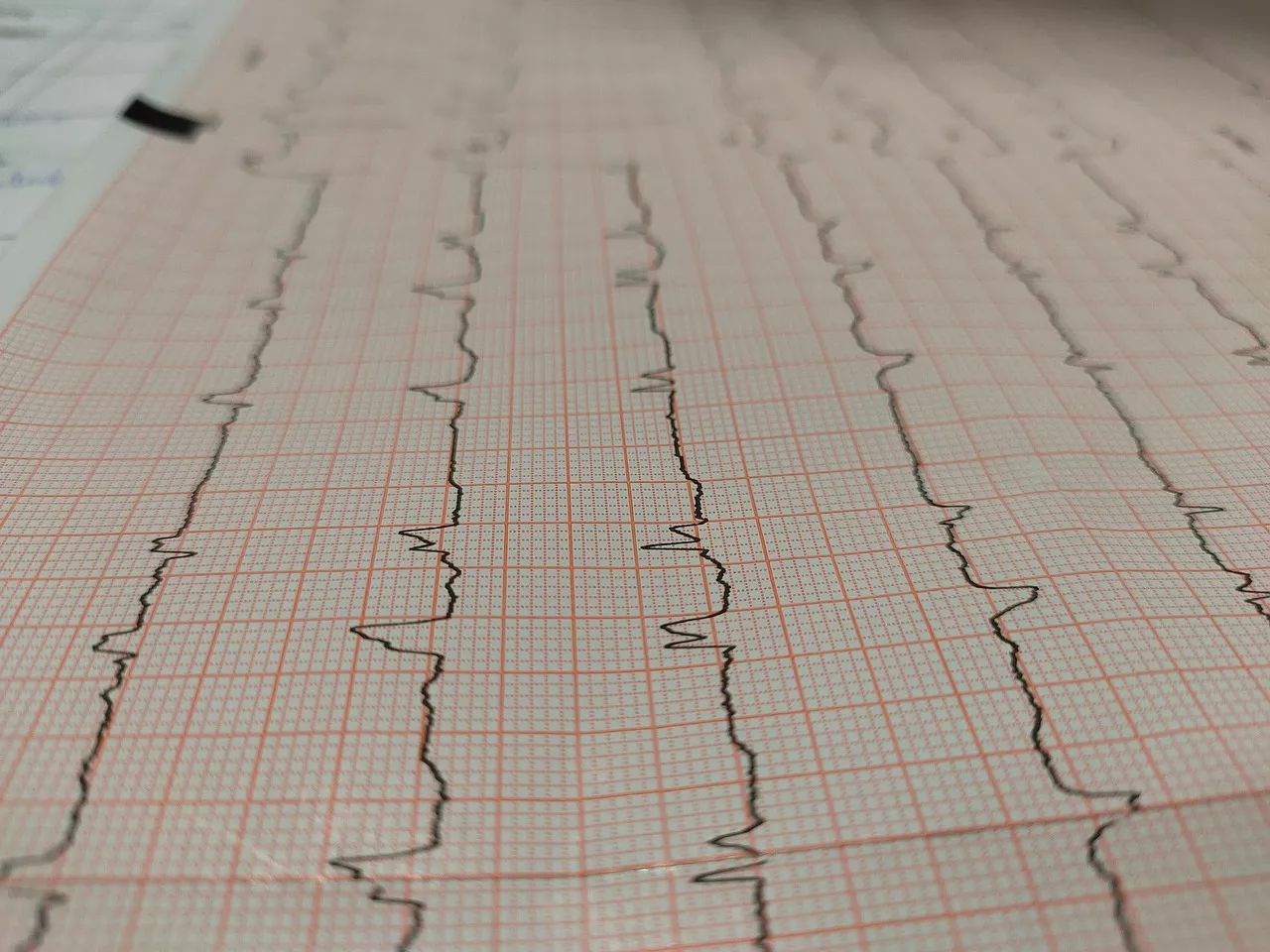 Cardiovascular Consultants